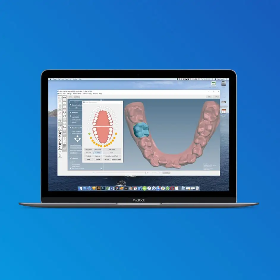 Orthoselect AI Integration