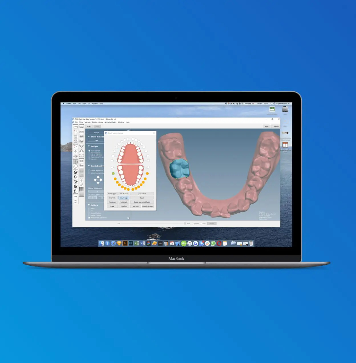 Orthoselect AI Case Study