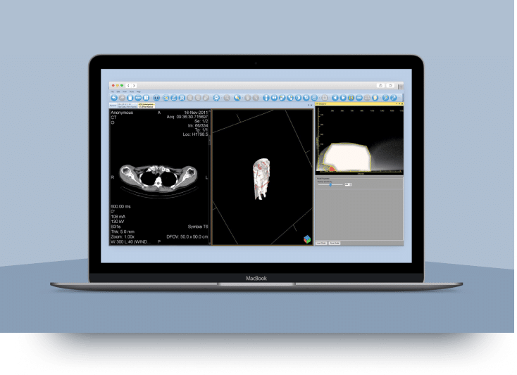 Tomographix Quantiva Workstation